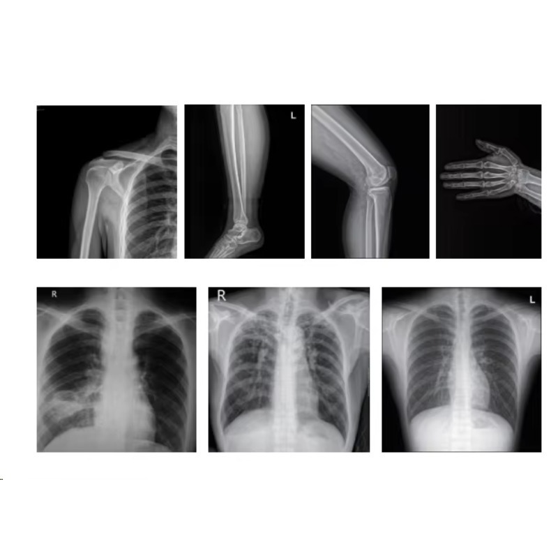 의료 영상 X선 기기 디지털 X선 촬영 시스템 가격 이 - Photography X Ray 리뷰 및 가격